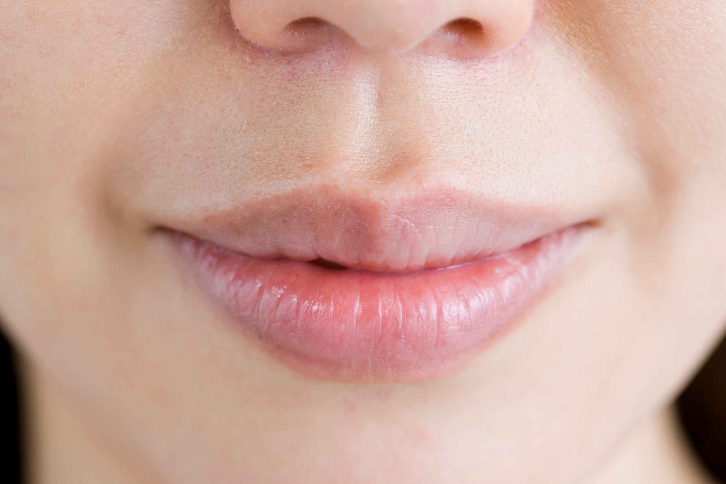 labios